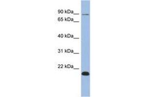 Image no. 1 for anti-Transcription Elongation Factor B Polypeptide 3B (Elongin A2) (TCEB3B) (AA 287-336) antibody (ABIN6742625)