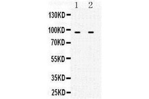 Observed bind size: 91KD (MCM3 Antikörper  (N-Term))