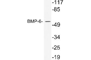 Western blot (WB) analysis of BMP-6 antibody in extracts from 293 cells treated with TNF. (BMP6 Antikörper)
