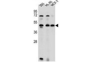 ANKRD40 Antibody (C-term) western blot analysis in 293,HL-60,MCF-7 cell line lysates (35µg/lane). (ANKRD40 Antikörper  (C-Term))