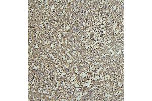 IHC analysis of CD69 using anti-CD69 antibody (ABIN7599623). (CD69 Antikörper  (AA 101-148))