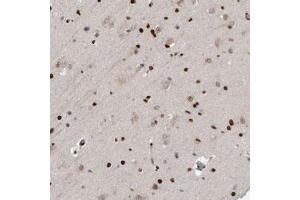 Immunohistochemical staining of human cerebral cortex with ZEB1 polyclonal antibody  shows strong nuclear positivity in glial cells at 1:500-1:1000 dilution. (ZEB1 Antikörper)