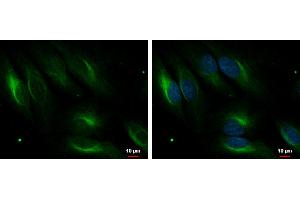 ICC/IF Image PDLIM4 antibody [C2C3], C-term detects PDLIM4 protein at cytoplasm by immunofluorescent analysis. (PDLIM4 Antikörper  (C-Term))