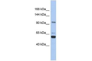WB Suggested Anti-TRPM8 Antibody Titration:  0. (TRPM8 Antikörper  (N-Term))