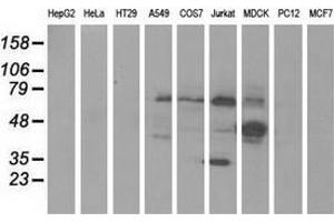Western blot analysis of extracts (35 µg) from 9 different cell lines by using anti-KLHL2 monoclonal antibody. (KLHL2 Antikörper  (AA 1-100, AA 494-593))