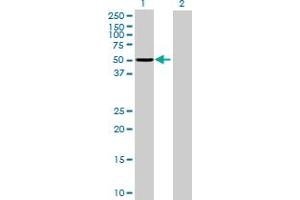 Western Blot analysis of ASNS expression in transfected 293T cell line by ASNS MaxPab polyclonal antibody. (Asparagine Synthetase Antikörper  (AA 1-561))