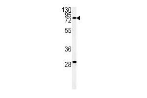 Western blot analysis of ZFYVE16 Antibody (N-term) (ABIN651313 and ABIN2840182) in K562 cell line lysates (35 μg/lane). (ZFYVE16 Antikörper  (N-Term))
