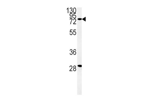 ZFYVE16 antibody  (N-Term)