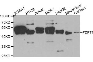 Western Blotting (WB) image for anti-Farnesyl-Diphosphate Farnesyltransferase 1 (FDFT1) antibody (ABIN1882356) (FDFT1 Antikörper)