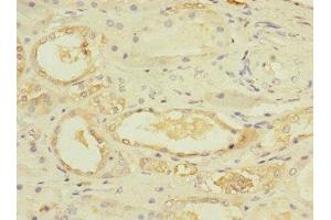 Immunohistochemistry of paraffin-embedded human kidney tissue using ABIN7174375 at dilution of 1:100 (UBE4A Antikörper  (AA 797-1066))