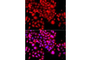 Immunofluorescence analysis of  cells using  antibody (ABIN6133295, ABIN6137172, ABIN6137173 and ABIN6223966). (ASCC3 Antikörper  (AA 1-111))