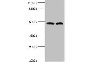 Western blot All lanes: Protein FAM114A2 antibody at 2 μg/mL Lane 1: Mouse kidney tissue Lane 2: U251 whole cell lysate Secondary Goat polyclonal to rabbit IgG at 1/10000 dilution Predicted band size: 55 kDa Observed band size: 55 kDa (FAM114A2 Antikörper  (AA 1-505))