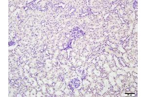 Immunohistochemistry (Paraffin-embedded Sections) (IHC (p)) image for anti-Alkaline Sphingomyelinase (Alk-Smase) (AA 351-458) antibody (ABIN706286)