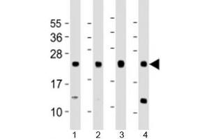 Western blot testing of human 1) A431, 2) HeLa, 3) HepG2 and 4) MCF-7 cell lysate with LITAF antibody at 1:1000. (LITAF Antikörper  (AA 31-60))