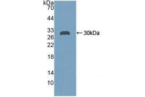 Detection of Recombinant CA2, Rat using Polyclonal Antibody to Carbonic Anhydrase II (CA2)