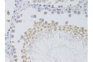 Immunohistochemistry of paraffin-embedded rat testis using PHC1 antibody (ABIN5973455) at dilution of 1/100 (40x lens). (PHC1 Antikörper)