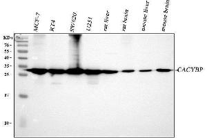 Western blot analysis of CACYBP using anti-CACYBP antibody (ABIN4886495). (CACYBP Antikörper  (N-Term))