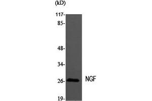 Western Blot analysis of MEF1 cells using NGF Polyclonal Antibody at dilution of 1:2000. (Nerve Growth Factor Antikörper)