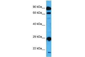 Host:  Mouse  Target Name:  MED6  Sample Tissue:  Mouse Testis  Antibody Dilution:  1ug/ml (MED6 Antikörper  (Middle Region))