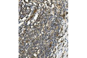 IHC analysis of TRIM25 using anti-TRIM25 antibody (ABIN7599495).