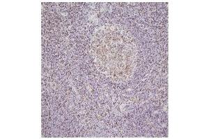 Immunohistochemistry This image shows paraffin-embedded human palatine tonsil tissue sample stained with anti-NPM antibody(5E3) at 1:100 dilution. (NPM1 Antikörper)