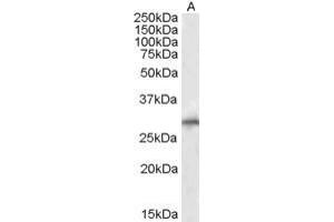 Western Blotting (WB) image for anti-E3 Ubiquitin-Protein Ligase SIAH1 (SIAH1) (N-Term) antibody (ABIN184675)