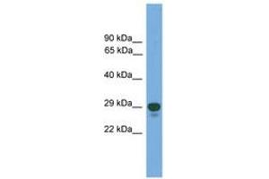 Image no. 1 for anti-Paired Related Homeobox 2 (PRRX2) (AA 71-120) antibody (ABIN6745633) (PRRX2 Antikörper  (AA 71-120))
