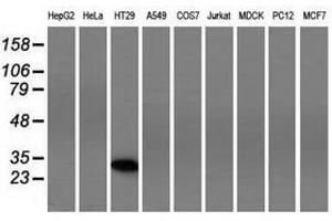 Image no. 2 for anti-Four and A Half LIM Domains 1 (FHL1) antibody (ABIN1500976) (FHL1 Antikörper)