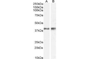 ABIN238549 (0. (IL12B Antikörper  (Internal Region))