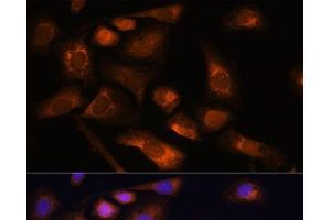 Immunofluorescence analysis of U-2 OS cells using RPS13 Polyclonal Antibody at dilution of 1:100. (RPS13 Antikörper)