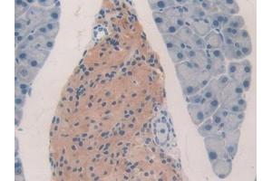 Immunohistochemistry (IHC) image for anti-serpin Peptidase Inhibitor, Clade A (Alpha-1 Antiproteinase, Antitrypsin), Member 6 (SERPINA6) (AA 268-391) antibody (ABIN7438403)