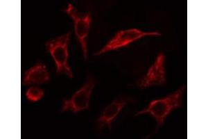 ABIN6267393 staining Hela cells by IF/ICC. (VAV1 Antikörper  (pTyr174))