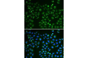 Immunofluorescence analysis of A549 cells using GPX4 antibody (ABIN6294188). (GPX4 Antikörper)