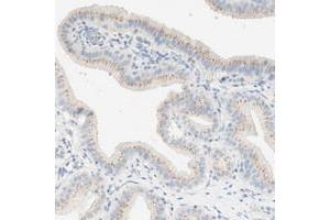 Immunohistochemical staining of human gallbladder with MANEA polyclonal antibody  shows moderate cytoplasmic positivity, with a granular pattern, in glandular cells. (MANEA Antikörper)