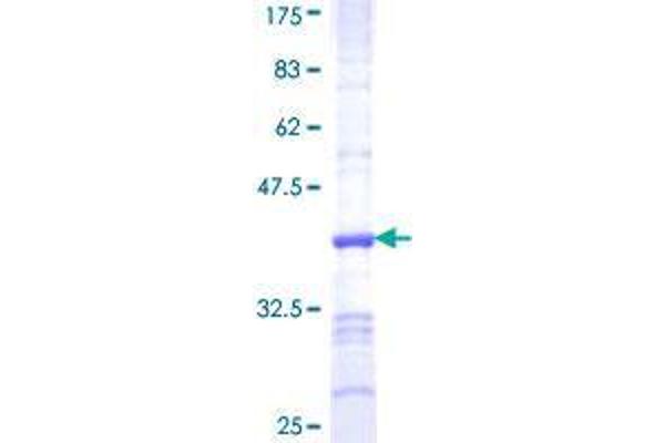 RASGEF1C Protein (AA 168-260) (GST tag)