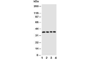 Western blot testing of CD1d antibody and Lane 1:  COLO320;  2: HeLa;  3: HT1080;  4: Jurkat cell lysate (CD1d Antikörper  (AA 76-92))