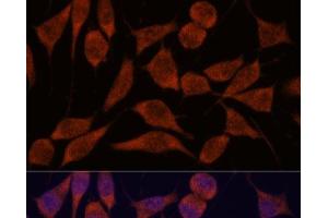 Immunofluorescence analysis of L929 cells using TRAPPC6A Polyclonal Antibody at dilution of 1:100. (TRAPPC6A Antikörper)