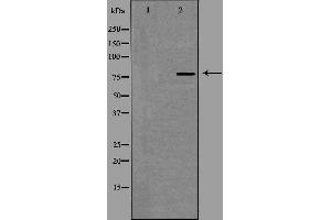 Western blot analysis of extracts from HepG2 cells using SLCO1A2 antibody.