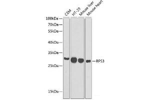 Western blot analysis of extracts of various cell lines using RPS3 Polyclonal Antibody at dilution of 1:1000. (RPS3 Antikörper)