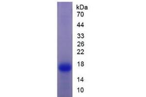 SDS-PAGE analysis of Rat Transthyretin Protein.