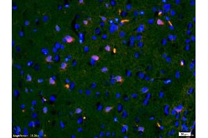 Formalin-fixed and paraffin-embedded rat brain labeled with Anti-IGFBP3 Polyclonal Antibody, Unconjugated (ABIN686497) 1:200, overnight at 4°C, The secondary antibody was Goat Anti-Rabbit IgG,Cy3 conjugated used at 1:200 dilution for 40 minutes at 37°C.