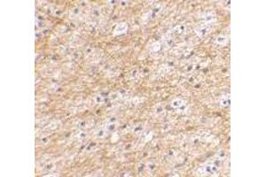 Immunohistochemical staining of human brain tissue using AP30032PU-N AIFM3 antibody at 2.