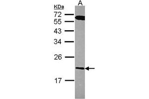 AP31125PU-N RGS10 antibody staining of A431 (Lane A) whole cell lysate (30 µg) at 1/1000 dilution, 12% SDS PAGE.