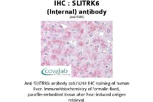 Image no. 1 for anti-SLIT and NTRK-Like Family, Member 6 (SLITRK6) (Internal Region) antibody (ABIN1739441) (SLITRK6 Antikörper  (Internal Region))