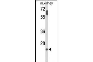 Western blot analysis of SMNDC1 Antibody (N-term) (ABIN653319 and ABIN2842811) in mouse kidney tissue lysates (35 μg/lane). (SMNDC1 Antikörper  (N-Term))