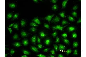 Immunofluorescence of monoclonal antibody to UBE2L3 on HeLa cell. (UBE2L3 Antikörper  (AA 1-154))