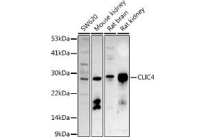 Western blot analysis of extracts of various cell lines, using CLIC4 antibody (ABIN6127638, ABIN6138723, ABIN6138724 and ABIN6222890) at 1:500 dilution. (CLIC4 Antikörper  (AA 1-253))