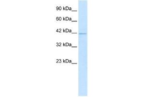 WB Suggested Anti-HOXA10 Antibody Titration:  1. (HOXA10 Antikörper  (N-Term))