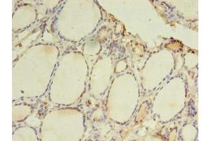 Immunohistochemistry of paraffin-embedded human thyroid tissue using ABIN7172278 at dilution of 1:100 (TLR6 Antikörper  (AA 32-586))