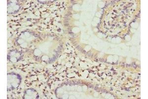 Immunohistochemistry of paraffin-embedded human small intestine tissue using ABIN7152794 at dilution of 1:100 (FGF19 Antikörper  (AA 25-216))